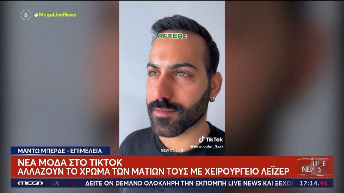 Νέα μόδα στο TikTok: Αλλαγή χρώματος ματιών με τατουάζ – «Έχουμε ξεφύγει»