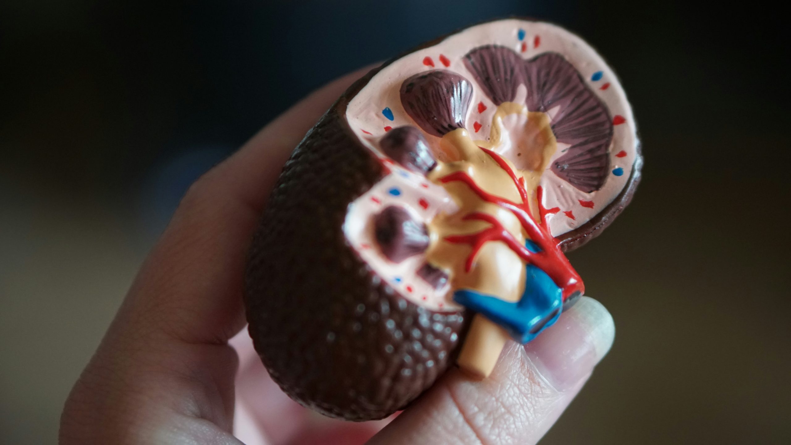 Πέτρες στους νεφρούς: Το Νο1 σημάδι που οι περισσότεροι άνθρωποι αγνοούν, σύμφωνα με γιατρούς