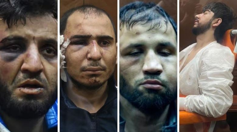 Μακελειό στη Μόσχα: Φρικτά βασανιστήρια στους συλληφθέντες – Ηλεκτροσόκ στα γεννητικά όργανα, έκοψαν αυτί και του έδωσαν να το φάει