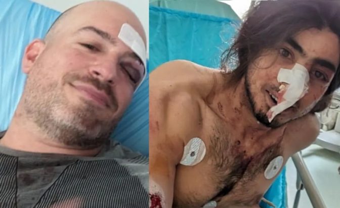 Πάρνηθα εθελοντές επίθεση