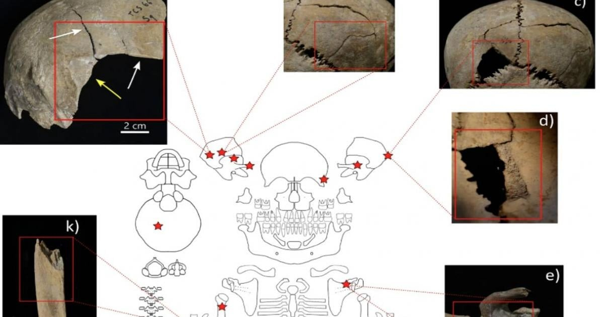 Κατανομή και παραδείγματα κρανιακών αλλοιώσεων στο Cornaux/Les Sauges.Υπήρξαν θύματα ενός αρχαίου τσουνάμι ή ανθρωποθυσίας; Πηγή: Zita Laffranchi et al./Επιστημονικές εκθέσεις