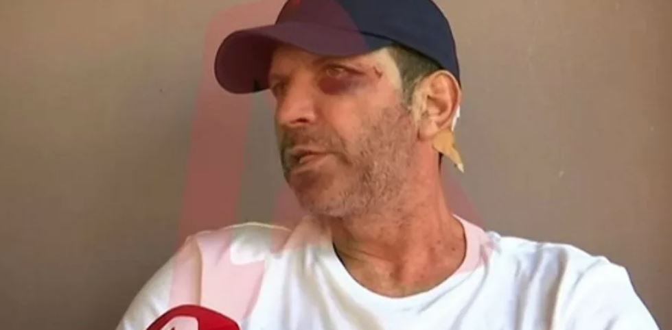 Αγρίνιο: Συγκλονίζει ο εστιάτορας που έπεσε θύμα άγριας επίθεσης επειδή… δεν τους άρεσε το φαγητό – «Μου άνοιξαν το κεφάλι σε δύο σημεία»