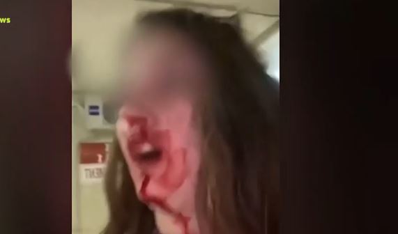 Άμφισσα Κακοποίηση