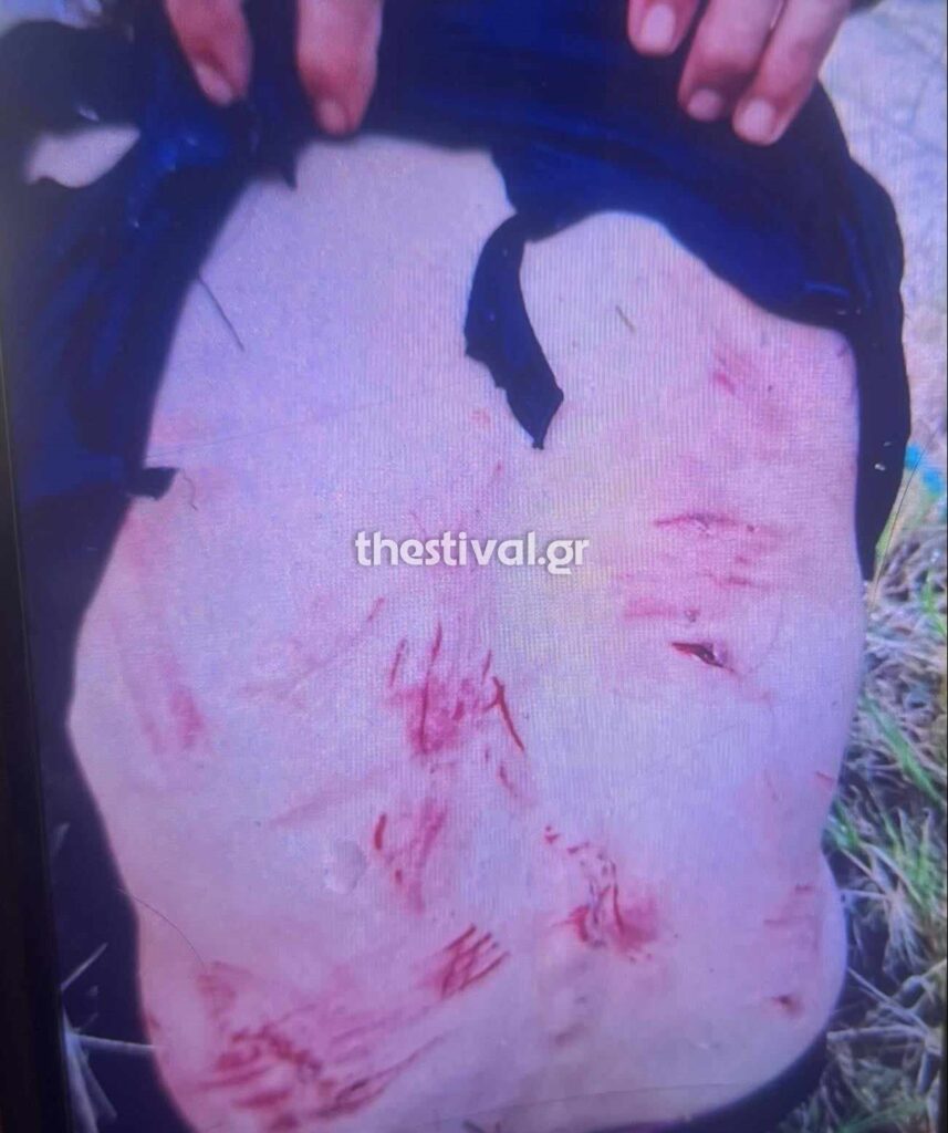 Θεσσαλονίκη Σκυλιά