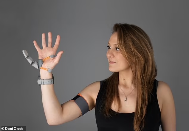 Τι θα κάνατε αν είχατε έναν τρίτο αντίχειρα; Ρομποτική προσθετική φέρνει την επανάσταση στις κινητικές ικανότητες των ανθρώπων