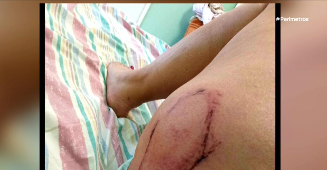 Χελώνα Επίθεση