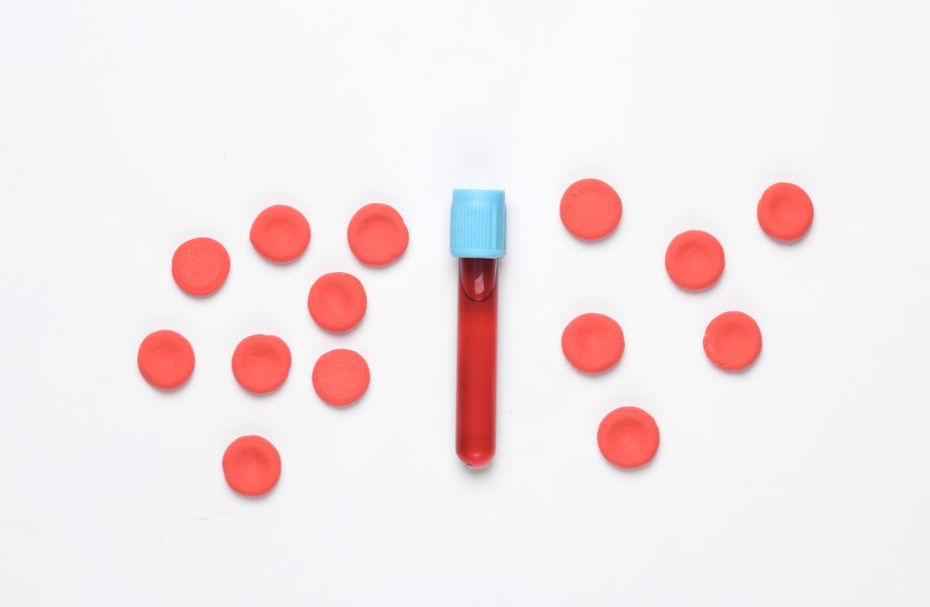 Αλτσχάιμερ