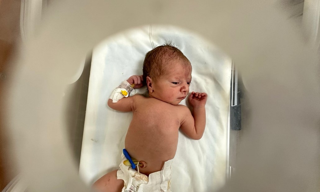 ΕΜΒΡΥΟ ΓΑΖΑ