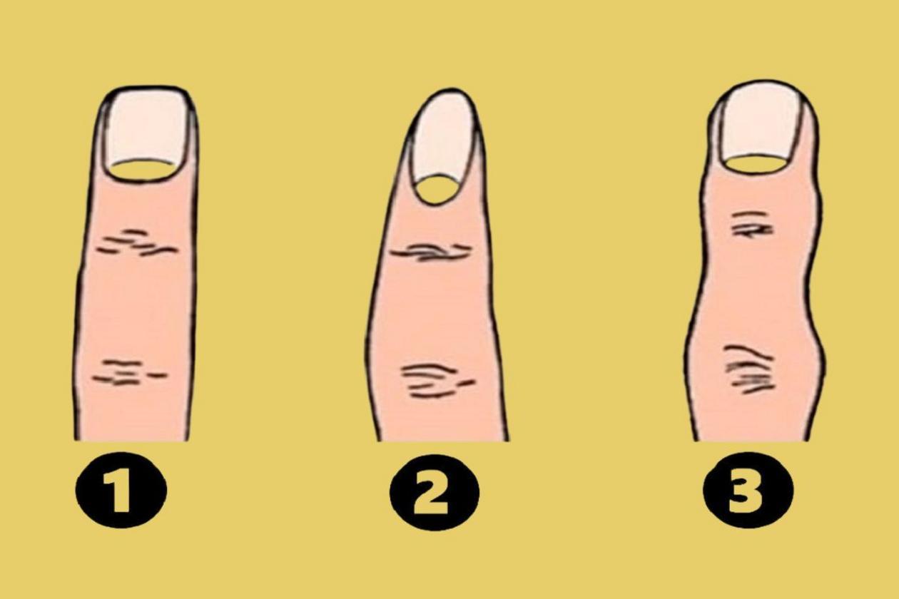 Τεστ προσωπικότητας: Το σχήμα των δαχτύλων σας αποκαλύπτει τα βαθύτερα χαρακτηριστικά σας