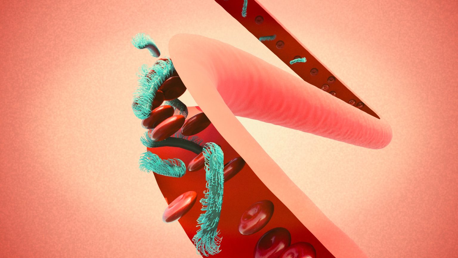 Η προτεινόμενη λύση αποτελείται από μια εξαιρετικά μικρή συσκευή εξέτασης (POCT) συνδεδεμένη με smartphone, που χρησιμοποιεί απλούς ηλεκτροχημικούς βιοαισθητήρες με τεχνολογία επικοινωνίας ενσωματωμένη σε μια μικρορευστοποιητική συσκευή. Σε αντίθεση με διάφορους βιοαισθητήρες που χρησιμοποιούν μεγάλα αντισώματα IgG για τη σύλληψη σχετικών φλεγμονωδών βιοδεικτών, η προτεινόμενη συσκευή POCT προσφέρει υψηλότερη ευαισθησία και σταθερότητα, καθώς και μετρήσεις σε πραγματικό χρόνο, αυξάνοντας σημαντικά την πιθανή εφαρμογή στα διαγνωστικά CRP. Η συσκευή που είναι εξοπλισμένη με τον βιοαισθητήρα μπορεί να συλλάβει και να ποσοτικοποιήσει την CRP με αποτελεσματικότητα παρόμοια με τις κλασικές και ακριβές εξετάσεις ELISA. Το σύστημα χρησιμοποιεί επίσης τεχνολογία επικοινωνίας κοντινού πεδίου (NFC), επιτρέποντας ασύρματη ανταλλαγή δεδομένων μεταξύ αισθητήρων και φορητών συσκευών. Τα αποτελέσματα μπορούν να εμφανίζονται σε smartphone Android, παρέχοντας στους χρήστες έναν αποτελεσματικό τρόπο συλλογής και ανάλυσης ηλεκτροχημικών δεδομένων σε πραγματικό χρόνο. Αξιόπιστη και οικονομικά αποδοτική διαγνωστική λύση «Η προτεινόμενη μέθοδος εφαρμόστηκε στην ανίχνευση της CRP σε ανθρώπινο αίμα που ελήφθη από ανώνυμους δότες. Τα πειραματικά αποτελέσματα έδειξαν ότι το σύστημα μπορεί να ποσοτικοποιήσει σωστά την CRP σε κλινικά σχετικά βιολογικά δείγματα χωρίς την ανάγκη προκαταρκτικών διαδικασιών», παρατηρεί ο καθηγητής Martin Jönsson-Niedziółka και καταλήγει: «Επομένως θα μπορούσε να χρησιμοποιηθεί για την αξιολόγηση της φλεγμονής, των λοιμώξεων που προκαλούνται από βακτήρια ή ιούς και την παρακολούθηση για αυξημένο κίνδυνο καρδιακών παθήσεων». Αργά ή γρήγορα, όλοι έρχονται αντιμέτωποι με τη φλεγμονή. Ανεξάρτητα από την αιτιολογία, οι γρήγορες και επιλεκτικές διαγνώσεις που επιτρέπουν την παρακολούθηση της αποτελεσματικότητας της θεραπείας σε πραγματικό χρόνο απέχουν πολύ από το να είναι ιδανικές. Επομένως, όταν υπάρχουν γρήγορες και φορητές συσκευές στην πραγματική ζωή, αναμφίβολα θα φέρουν επανάσταση σε πολλούς τομείς της ιατρικής διάγνωσης, διευκολύνοντας τη ζωή πολλών ασθενών. Η συσκευή που παρουσίασαν ερευνητές στο IPC PAS παρέχει μια αξιόπιστη και οικονομικά αποδοτική διαγνωστική λύση που προσφέρει φιλική προς το χρήστη λειτουργία και γρήγορα αποτελέσματα μέσα σε λίγα λεπτά από την άνεση του σπιτιού του. Παρέχει επίσης επαναληψιμότητα τόσο στην παραγωγή βιοαισθητήρα όσο και στην ανίχνευση CRP, καθιστώντας ένα βήμα προς τη σύγχρονη και εξατομικευμένη υγειονομική περίθαλψη. Τα ηλεκτρόδια που βασίζονται σε νανοσωματίδια επιτρέπουν τη διενέργεια πολλαπλών αναλύσεων σε πραγματικό χρόνο, επιταχύνοντας τη διάγνωση και την αξιολόγηση της αποτελεσματικότητας της θεραπείας, επιτρέποντας έτσι άμεσες αποφάσεις θεραπείας και βελτιώνοντας τα αποτελέσματα των ασθενών.