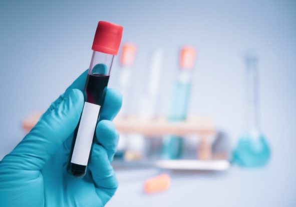 Καρκίνος παχέος εντέρου: Νέα εξέταση αίματος τον εντοπίζει έγκαιρα - Λιγότερο επεμβατική από την κολονοσκόπηση