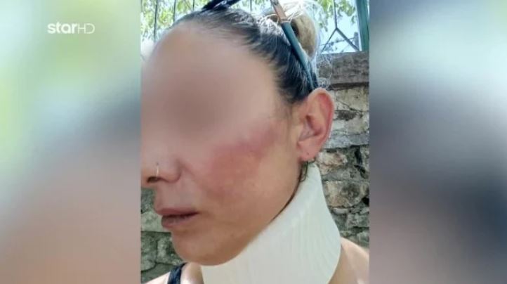 Λέσβος: Συνελήφθη ο πυροσβέστης που κατηγορείται ότι ξυλοκόπησε την σύντροφό του μπροστά στο παιδί τους