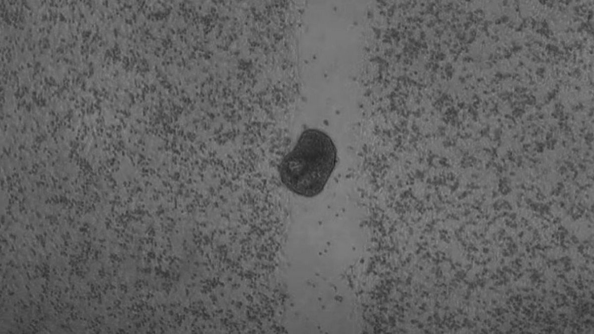 Οι επιστήμονες ανακάλυψαν μια «τρίτη κατάσταση» που είναι πέρα ​​από τη ζωή και τον θάνατο – Γνωρίστε τα «anthrobots»