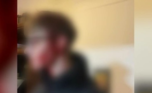 Θεσσαλονίκη: «Η κοπέλα φώναζε “βοήθεια”, το παλικάρι ήταν μέσα στα αίματα» – Τι λέει αυτόπτης μάρτυρας της επίθεσης εναντίον 16χρονου και 14χρονης