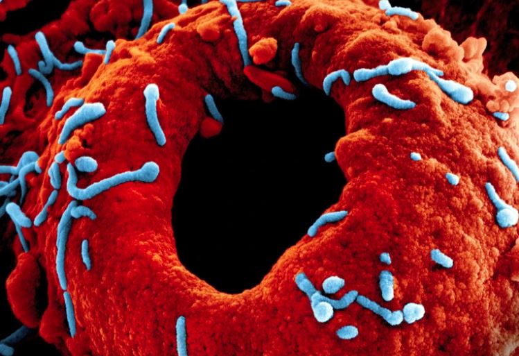 ΙΟΣ ΜΑΡΜΠΟΥΡΓΚ