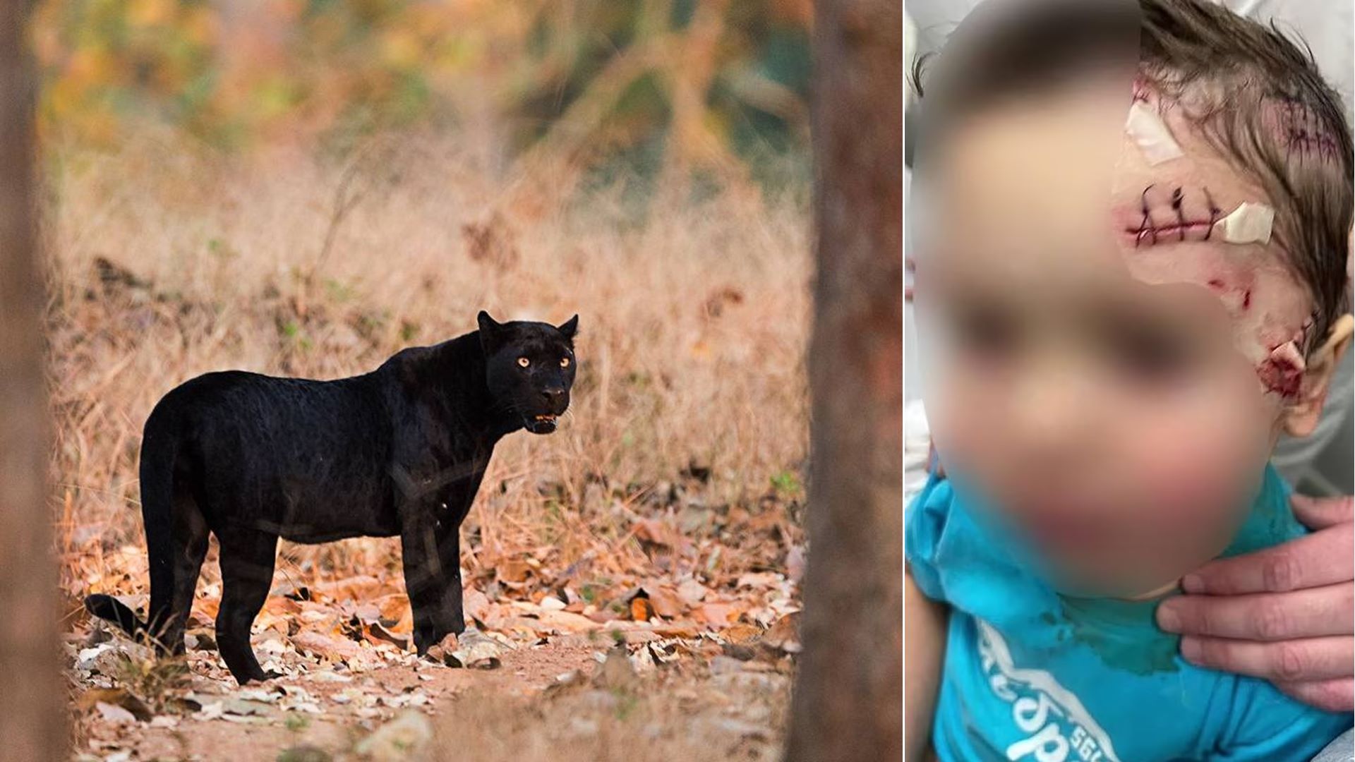 Πάνθηρας σε τσίρκο τραυμάτισε αγόρι – Η επίθεση προκλήθηκε έπειτα από επικίνδυνη πρωτοβουλία του πατέρα