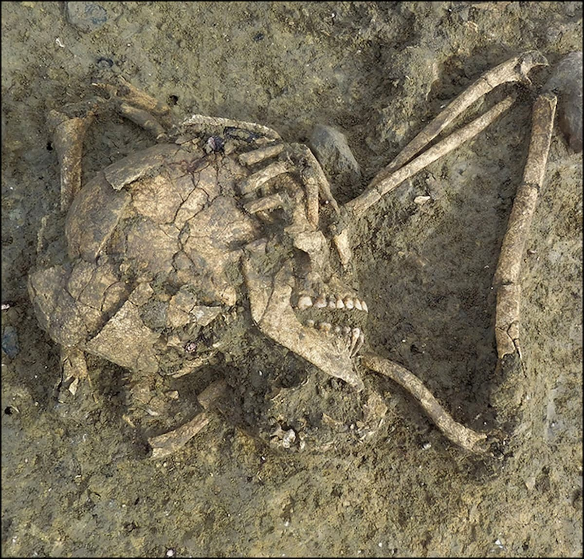 Το δεξί χέρι όπως κρατά το κρανίο.