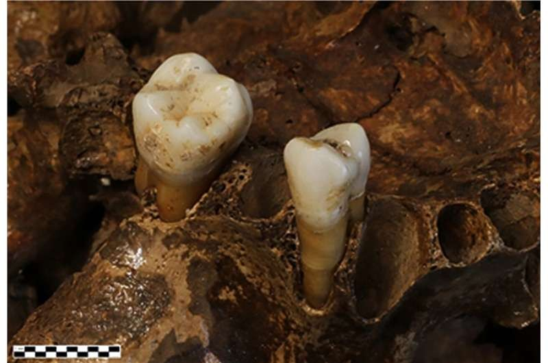 Φωτογραφία του γομφίου.