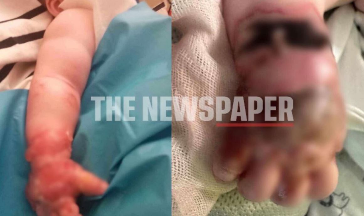 ΜΩΡΑΚΙ ΒΟΛΟΣ