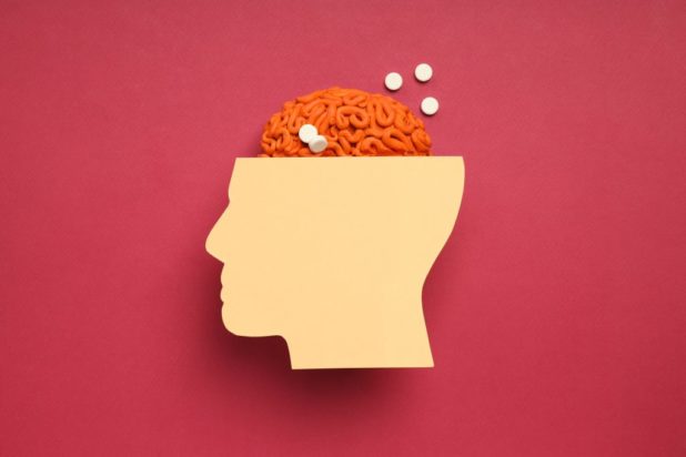 Αλτσχάιμερ