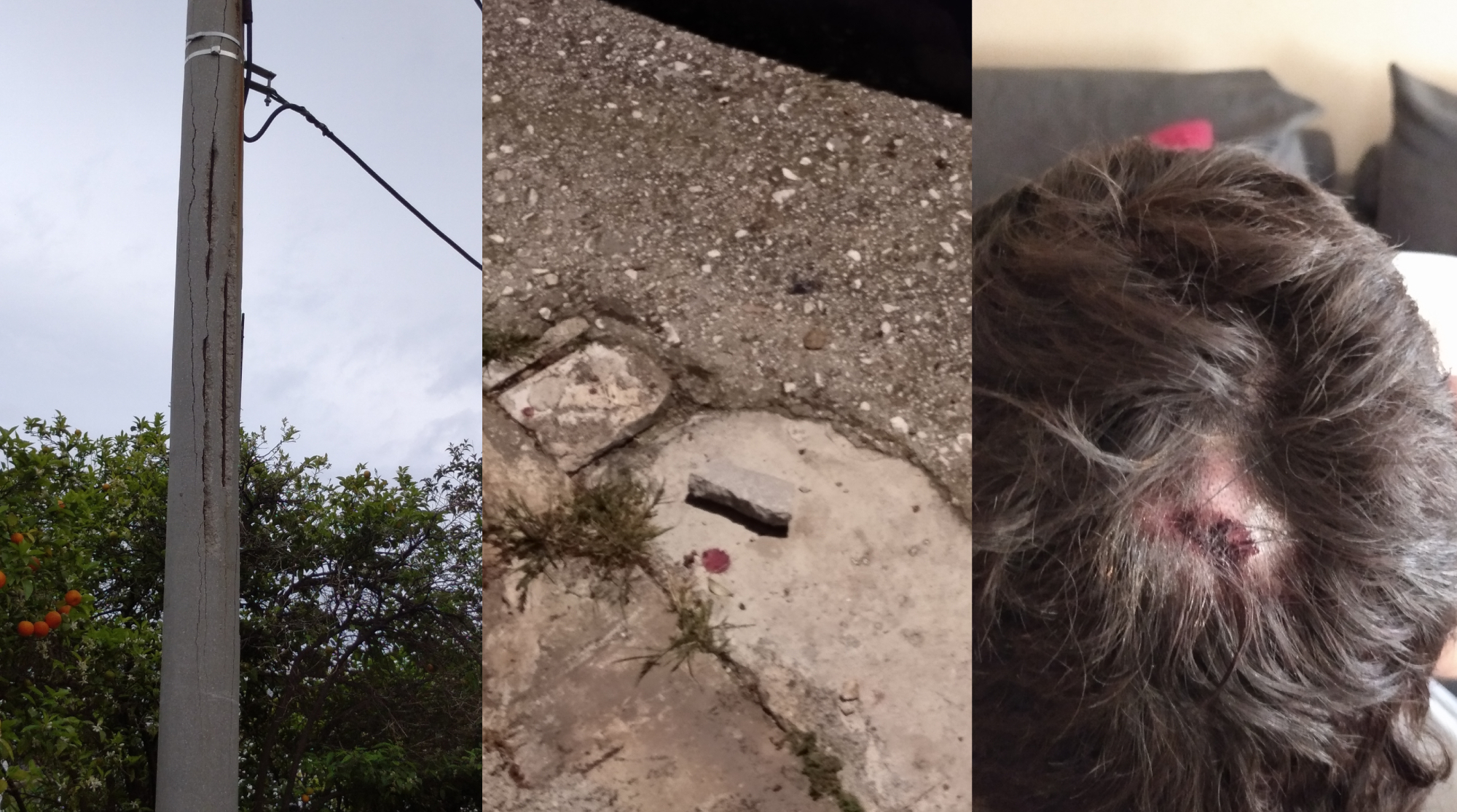 Νέο Ψυχικό: Τραυματισμός 17χρονου από ετοιμόρροπη κολώνα – ΦΩΤΟ