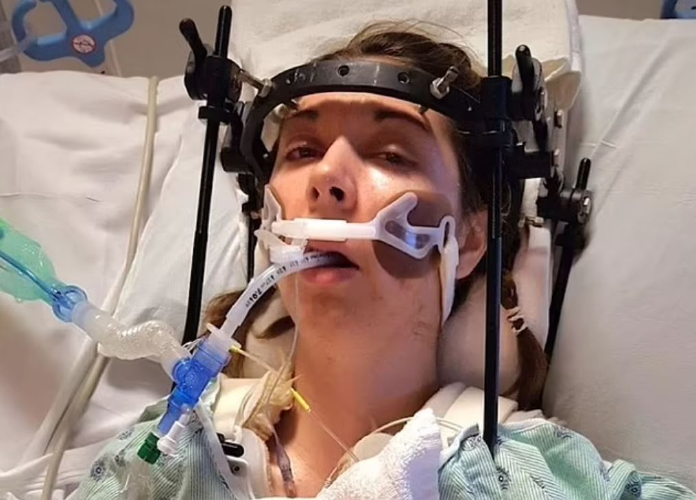 ΗΠΑ: Πώς οι γιατροί ξανακόλλησαν το κεφάλι γυναίκας που είχε υποστεί εσωτερικό αποκεφαλισμό