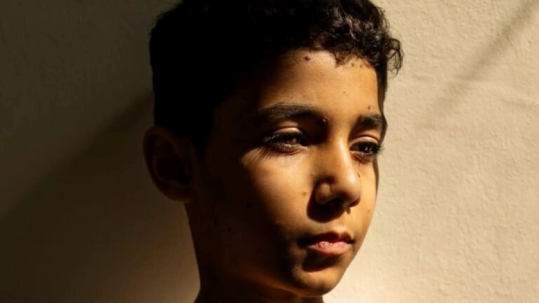 World Press Photo 2025: Η φωτογραφία του 9χρονου ακρωτηριασμένου Παλαιστίνιου που απέσπασε το πρώτο βραβείο – «Μαμά, πώς θα σε αγκαλιάζω;»