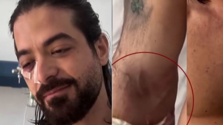 Μουγκοπέτρος Άρης