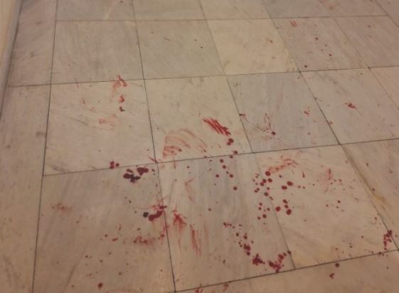 Νομική, επίθεση