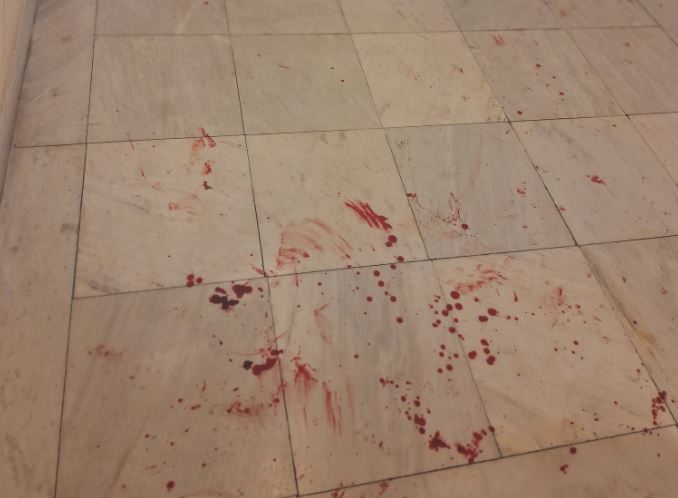 Νομική, επίθεση