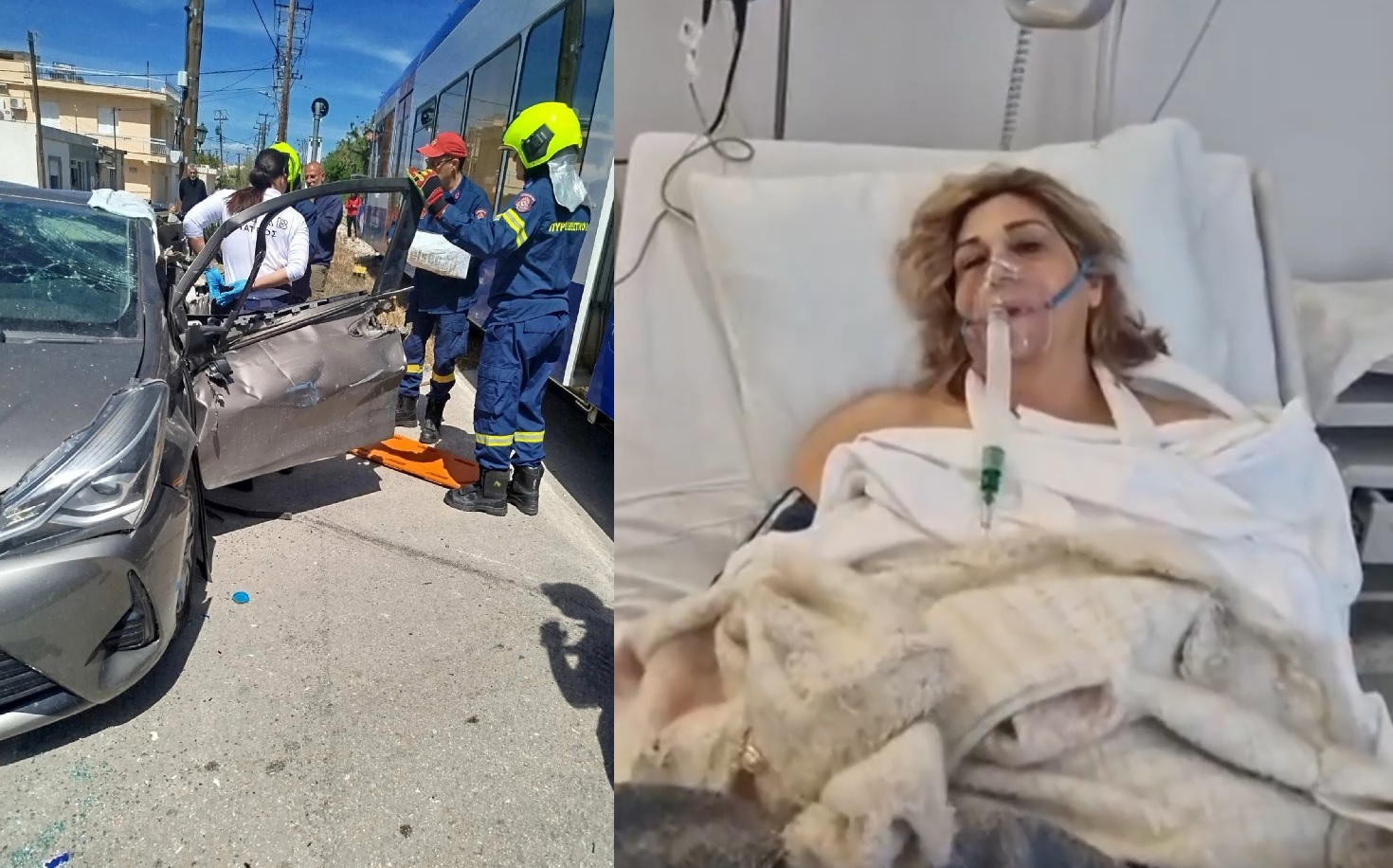 Σύγκρουση αυτοκινήτου με τρένο στην Πάτρα: Από εφημερία 36 ωρών επέστρεφε η γιατρός που τραυματίστηκε – «Δεν θυμάμαι τίποτα»