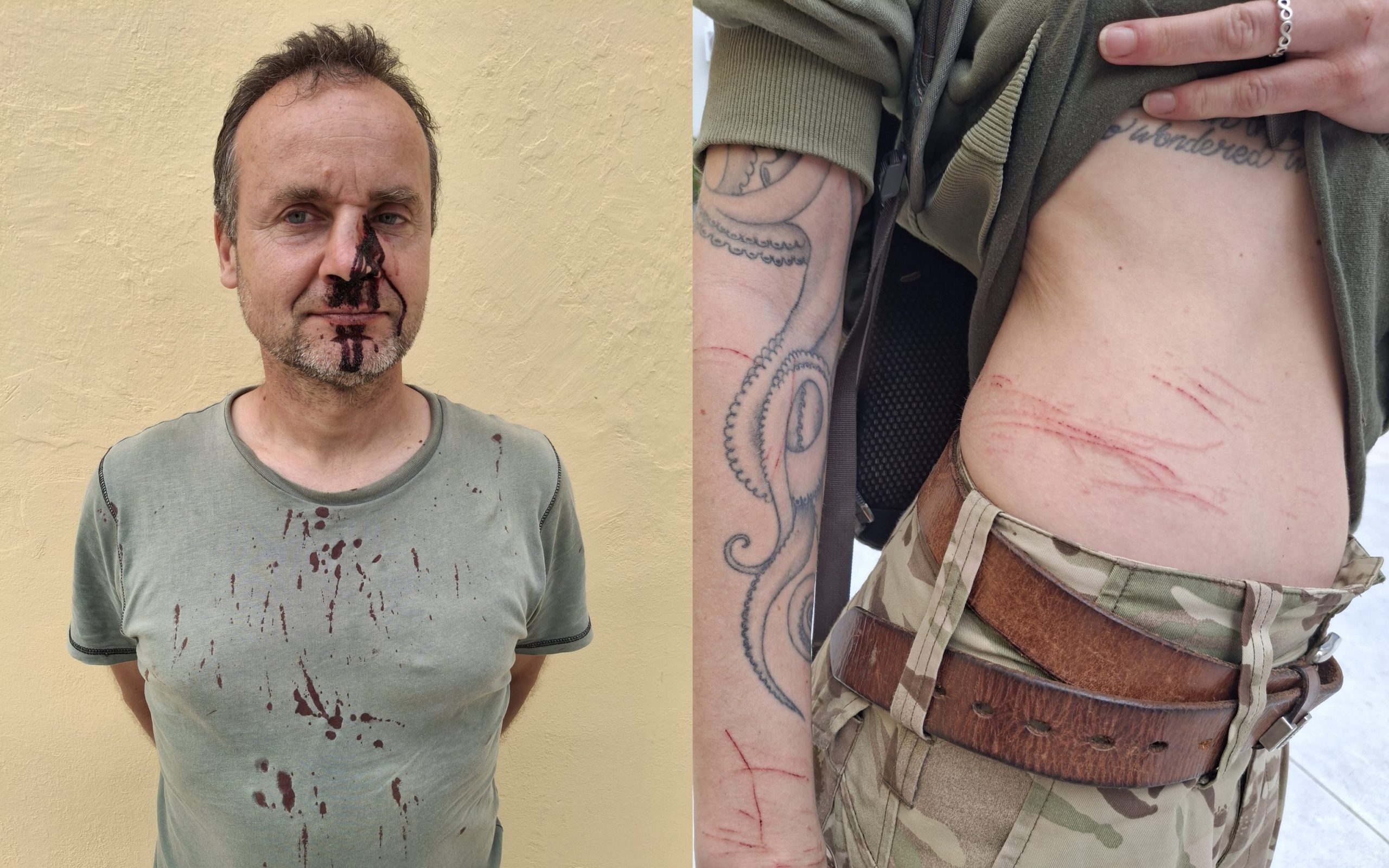 Ζάκυνθος: Άγρια επίθεση από λαθροκυνηγούς καταγγέλλουν ορνιθολόγοι – Τρεις τραυματίες