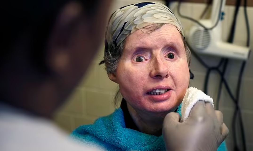 ΓΥΝΑΙΚΑ ΧΙΜΠΑΤΖΗΣ