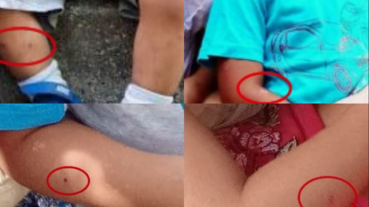 Λάρισα, σημάδια, κακοποίηση