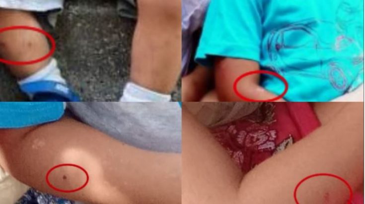 Λάρισα κακοποιημένα παιδιά σημάδια