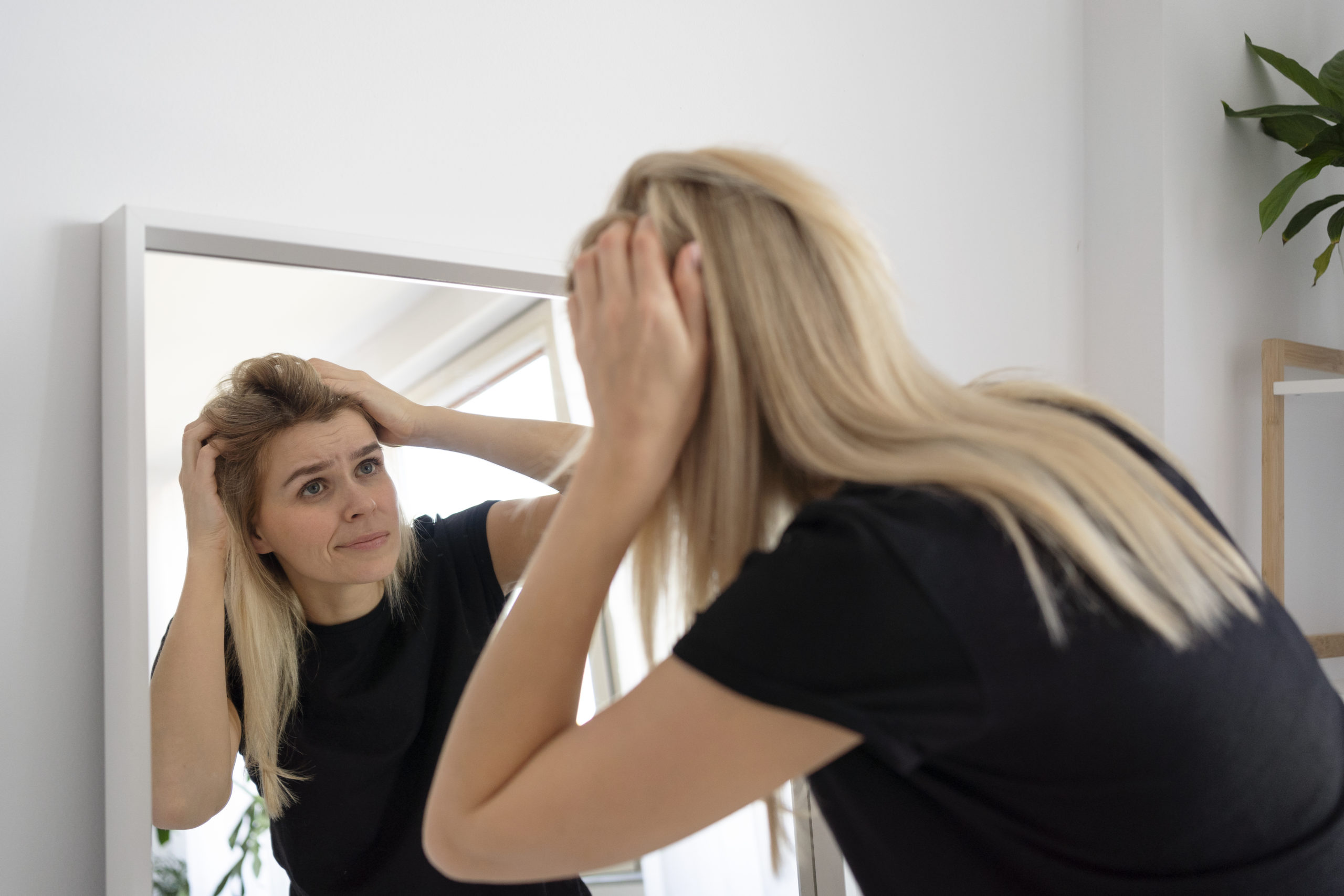 Τριχόπτωση: Η Νο1 ομάδα τροφίμων που μπορεί να προκαλέσει απώλεια μαλλιών, σύμφωνα με ειδικό