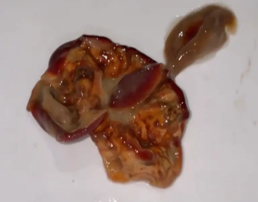 σφαίρα που βρέθηκε στον πάτο του μπουκαλιού.