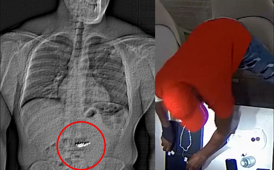 Βίντεο: Αστυνομικοί συλλαμβάνουν ληστή που κατάπιε διαμάντια αξίας 770.000  ευρώ