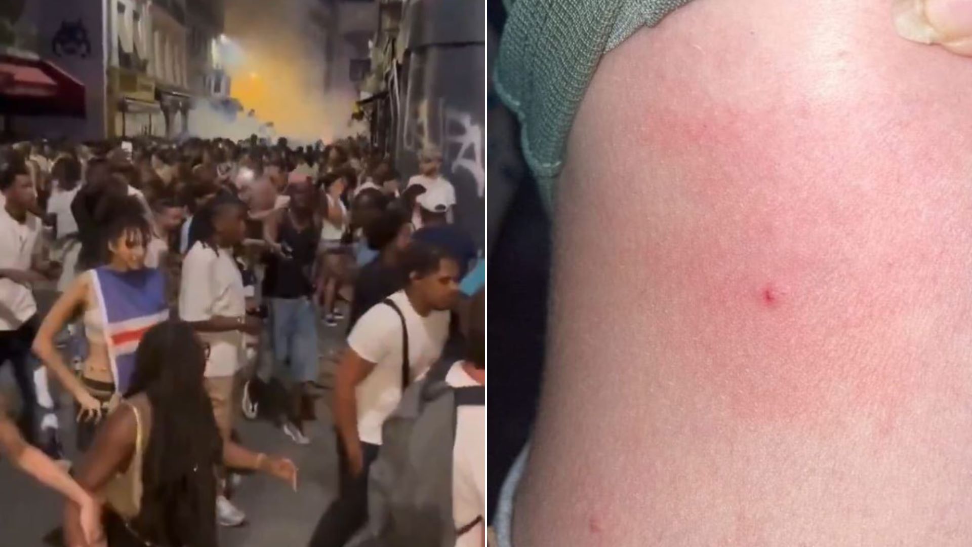 Σοκ στην Γαλλία: Επιθέσεις με σύριγγες κατά την διάρκεια του μουσικού φεστιβάλ Fête de la Musique – 145 θύματα, 12 συλλήψεις