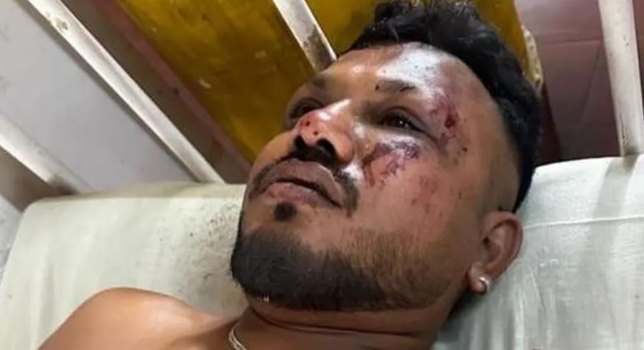 Τραγωδία στην Ινδία: Εντοπίστηκε ζωντανός επιβάτης του αεροσκάφους που συνετρίβη – «Όλα συνέβησαν τόσο γρήγορα, όταν σηκώθηκα υπήρχαν πτώματα παντού γύρω μου»