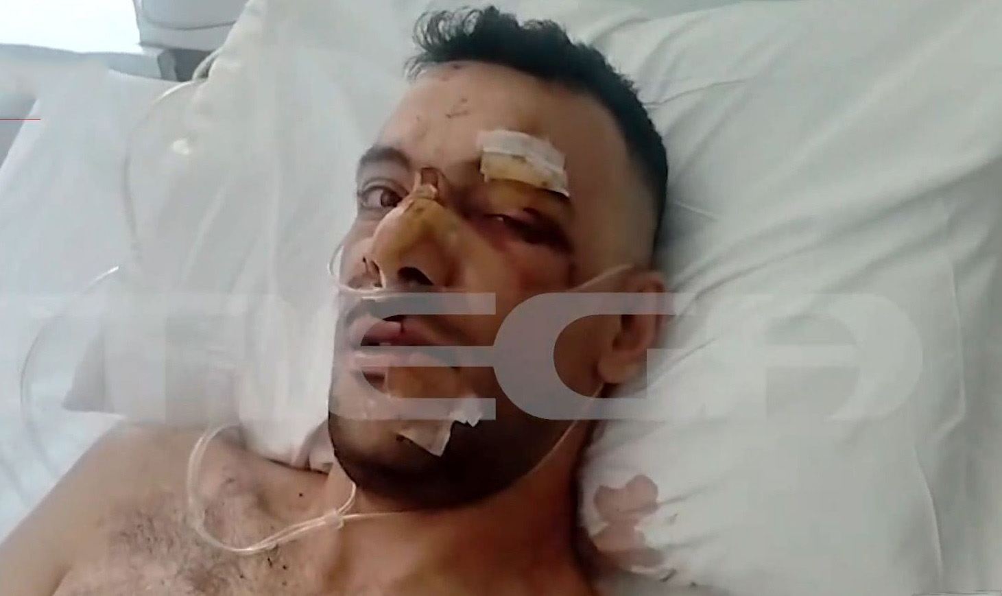 Αιματηρό επεισόδιο σε πανηγύρι στη Λέσβο: «Ήταν αποφασισμένος να σκοτώσει» λέει ο πατέρας του 32χρονου που δέχθηκε 18 μαχαιριές