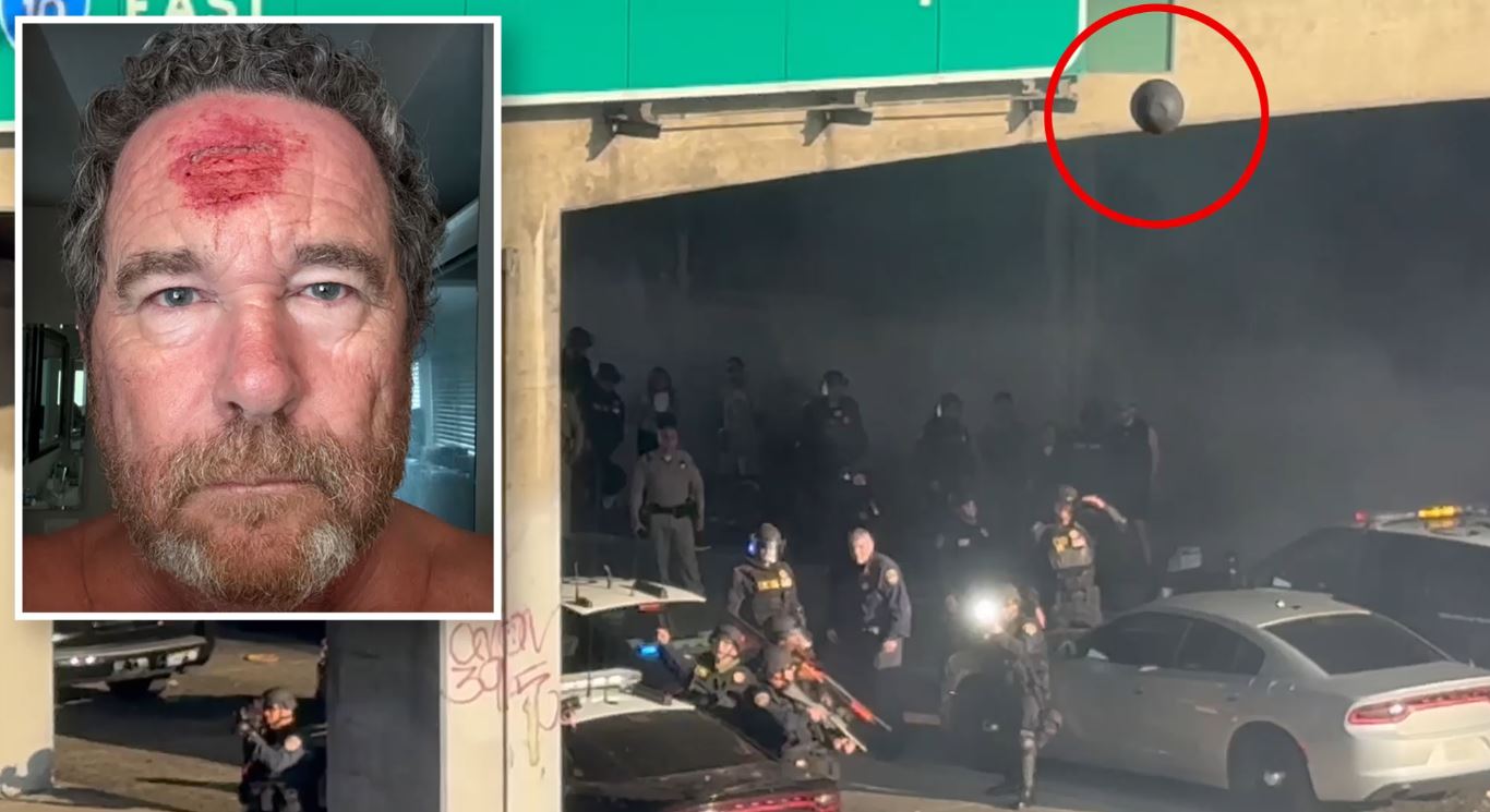 Λος Άντζελες: Φωτορεπόρτερ της New York Post δέχθηκε πλαστική σφαίρα στο μέτωπο – Δείτε το βίντεο