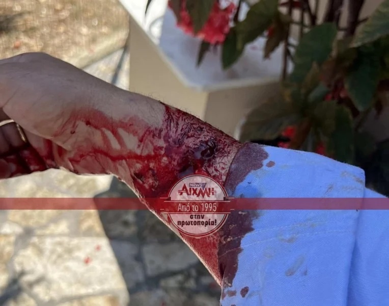 χερι τραυματισμένο 