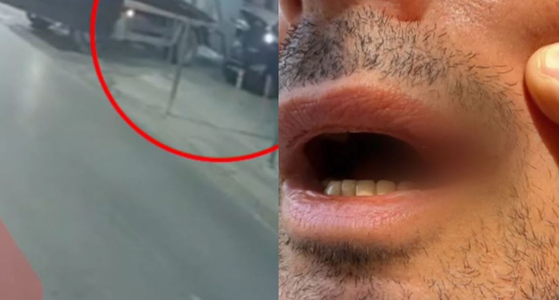 Πετρούπολη: Βίντεο ντοκουμέντο από την επίθεση δικυκλιστή σε υπάλληλο καθαριότητας – «Έπρεπε να κάνεις στην άκρη για να μπορέσω να περάσω»