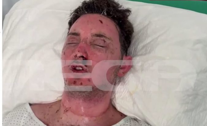 Σέρρες, έκρηξη, 19χρονος ψυκτικός