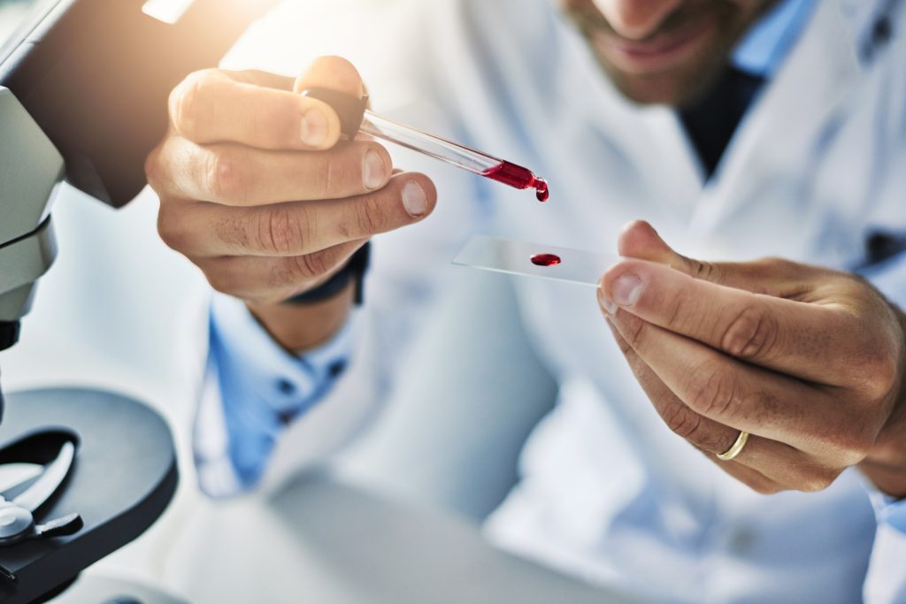Πρωτοποριακό τεστ αίματος ανιχνεύει τον καρκίνο 3 χρόνια πριν εμφανιστούν τα συμπτώματα