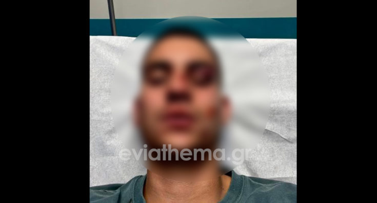 Χαλκίδα, ξυλοδαρμός