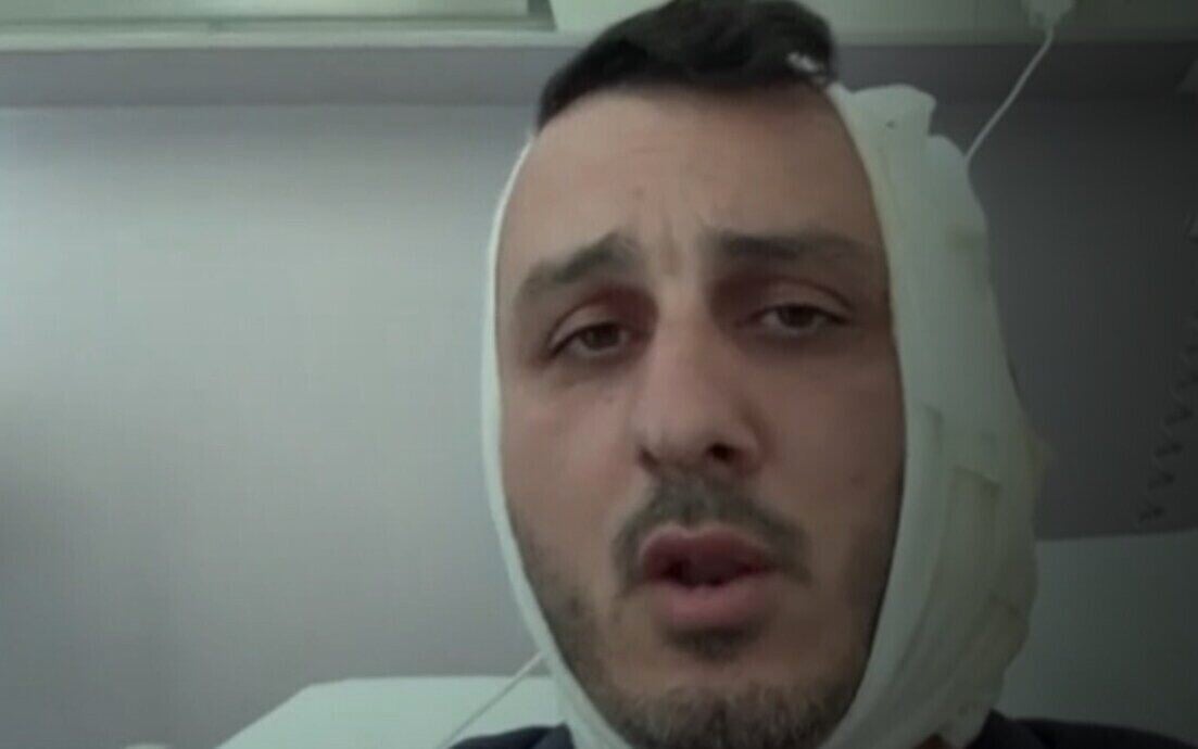 Άλιμος: Ισραηλινός τουρίστας καταγγέλλει άγρια επίθεση από Σύρο στην παραλία – Του δάγκωσε το αυτί και φώναζε «είμαι Χαμάς»