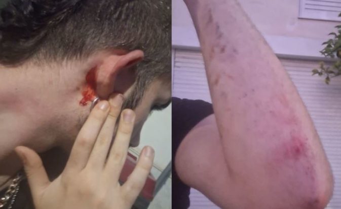 Ανθούπολη Ομοφοβική Επίθεση