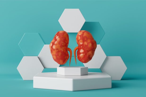 Νεφρά: Ποιες τροφές μπορούν να προκαλέσουν νεφρική βλάβη; Πώς να προστατευτείτε;